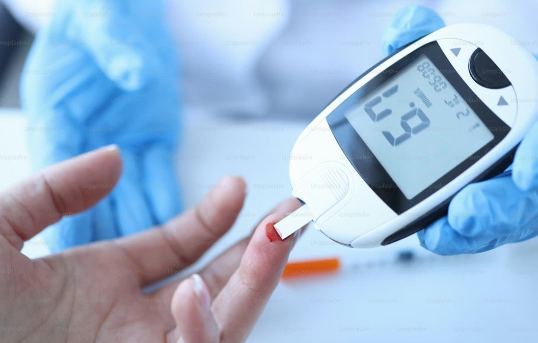 The Ultimate Guide to Continuous Glucose Monitors (CGMs) for Biohacking for Peak Performance